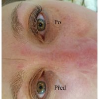 prodluzovani-ras-relax-bez-vrasek-lucie-glamour-lashes-2