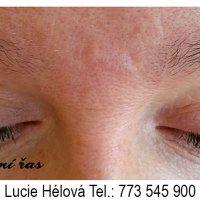 prodluzovani-ras-relax-bez-vrasek-lucie-vicerozmerne-objemove-4D-22