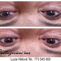 prodluzovani-ras-relax-bez-vrasek-lucie-set-glamour-lashes-29