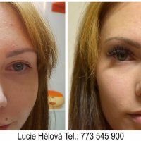 prodluzovani-ras-relax-bez-vrasek-lucie-set-glamour-lashes-56