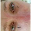prodluzovani-ras-relax-bez-vrasek-lucie-glamour-lashes-2